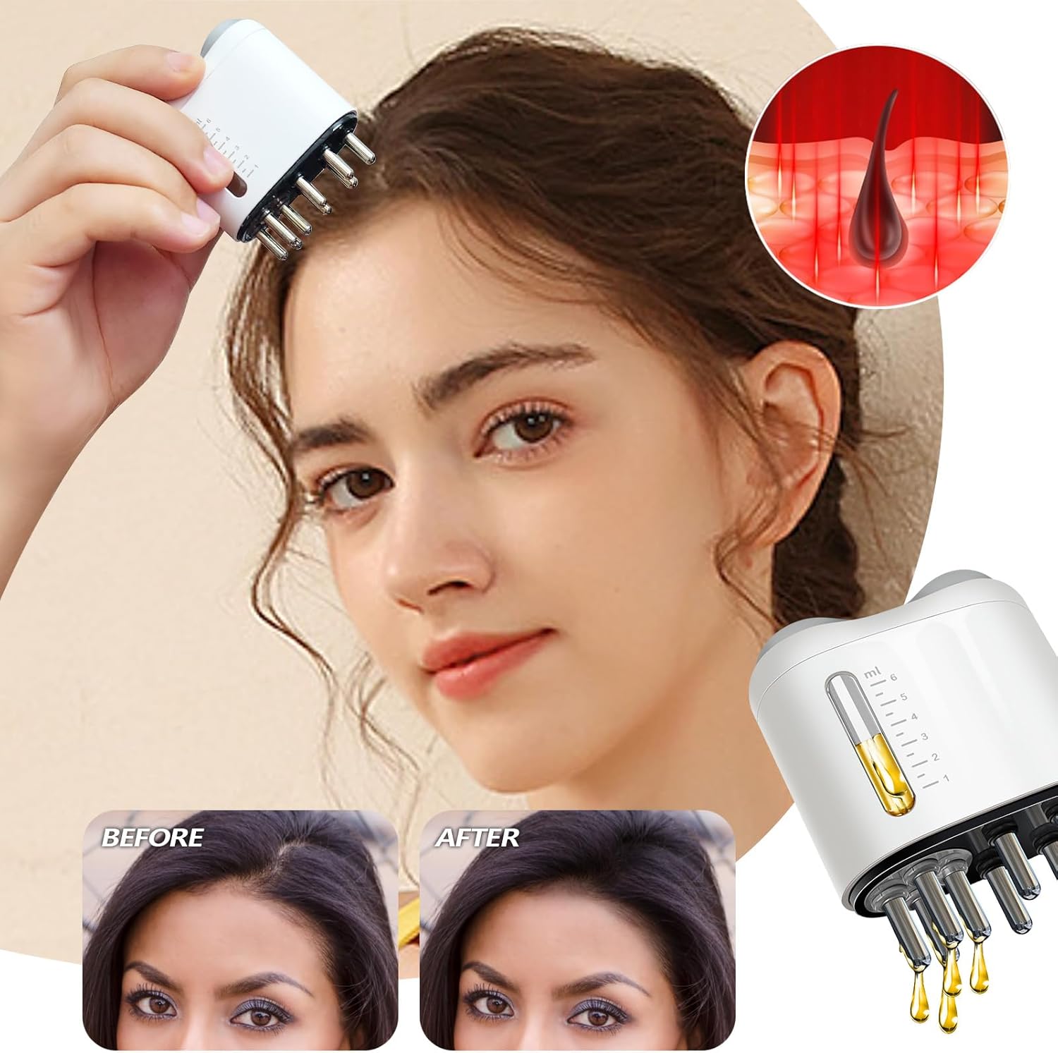 minoxidil applicator, hair oiling applicator hr02 minoxidil applicator, hair oiling applicator hr02